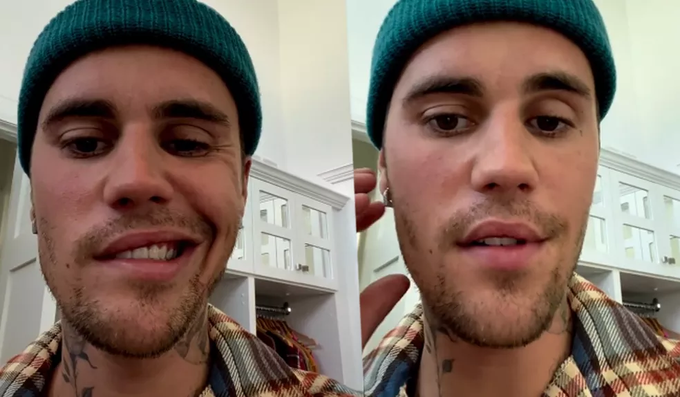 Justin Bieber revela que está com paralisia facial: “Eu tenho esperança”