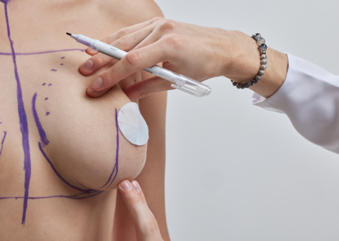 Brasil é modelo na especialização de cirurgiões de mama em técnicas oncoplásticas